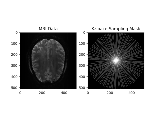 MRI Data, K-space Sampling Mask