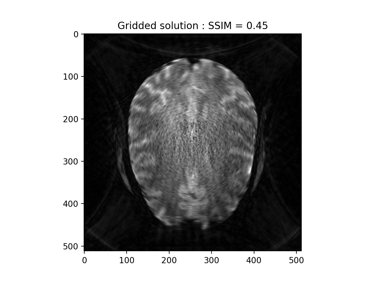 GPU Density Compensation Reconstruction Comparison — pysap v0.2.1