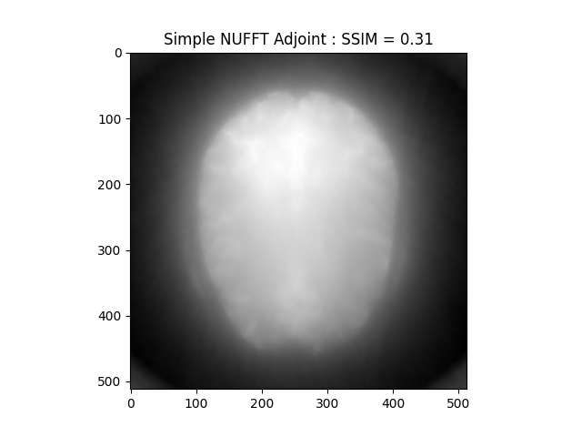 Simple NUFFT Adjoint : SSIM = 0.31