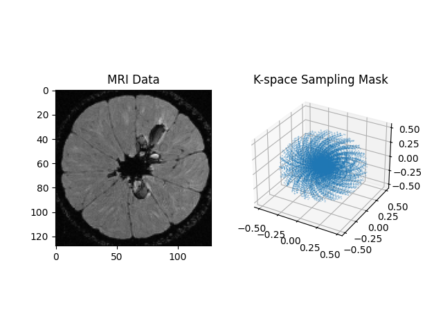 MRI Data, K-space Sampling Mask