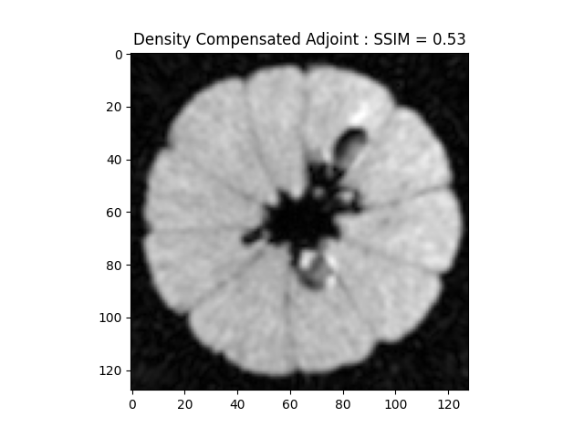 Density Compensated Adjoint : SSIM = 0.53