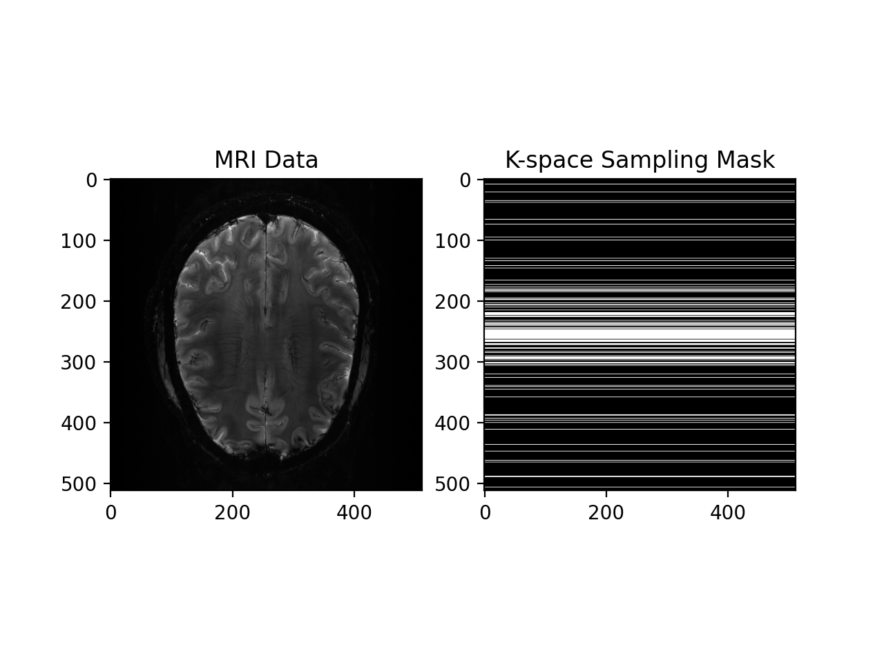 Cartesian Self Calibrating Reconstruction — pysap v0.2.1