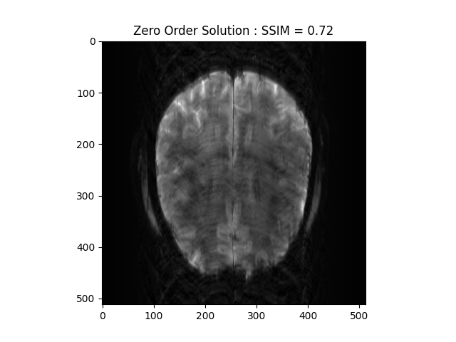 Zero Order Solution : SSIM = 0.72