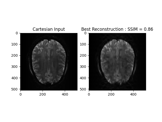 Cartesian Input, Best Reconstruction : SSIM = 0.86